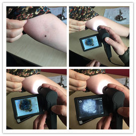 Video pelle elettronica professionale Inspecter di Dermatoscope con la micro carta di deviazione standard