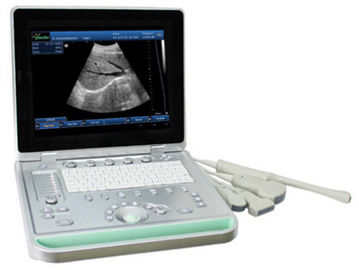analizzatore portatile di ultrasuono del computer portatile di 3D Digital con tutti i tipi di sonda