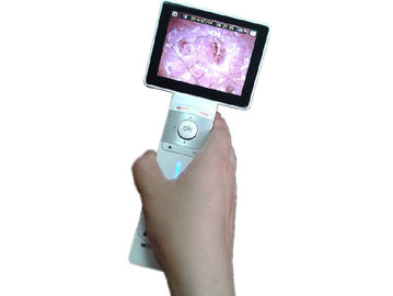 La macchina della lente dei capelli della macchina fotografica della pelle di Digital con mini porta USB trasmette le immagini al PC che visualizza le immagini allo stesso tempo