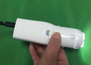 Colposcope elettronico di Digital della macchina fotografica vaginale per trovare malattia della cervice Eealier