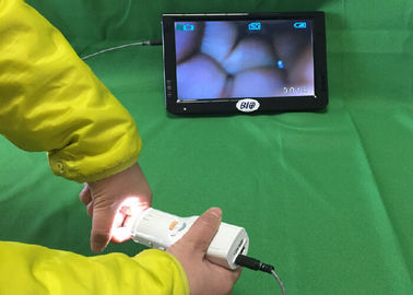 X Colposcope elettronico di Digital di 1,5 ingrandimenti si collega alla TV o computer o monitor medico per salute di s delle donne '