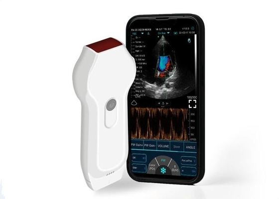 Scanner ad ultrasuoni personale Sonda lineare + cardiaca Formato DICOM mobile da 2,2 MHz