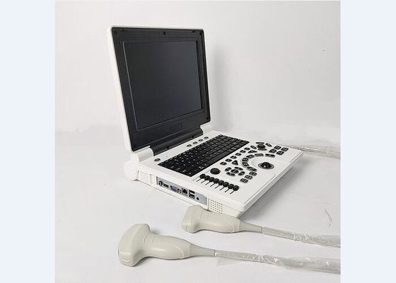 Sistema a ultrasuoni a colori per scanner per vescica portatile portatile portatile con 2 connettori per sonda
