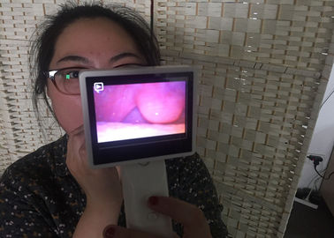 Otoscopio medico di Digital della videocamera di Rhinoscopy di endoscopia OTORINOLARINGOIATRICA per il naso che controlla con lo schermo LCD
