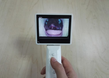 Oftalmoscopio diagnostico OTORINOLARINGOIATRICO dell'otoscopio dell'attrezzatura di stoccaggio di carta di deviazione standard automaticamente con il cavo di USB