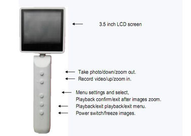 Oftalmoscopio diagnostico tenuto in mano dell'otoscopio di Digital della videocamera il video con USB ha prodotto il collegamento facoltativo di WIFI