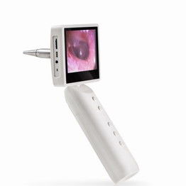 Video orecchio dell'oftalmoscopio dell'otoscopio che controlla con la batteria ricaricabile smontabile