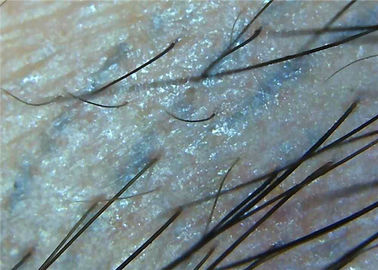 microscopio Digital video Dermatoscope della pelle della lente 1000x per il microscopio pieno di ispezione medica