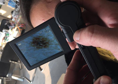 Video controllore della superficie della pelle di USB dell'analizzatore della pelle di Digital del microscopio di Dermatoscope con il monitor a 3 pollici