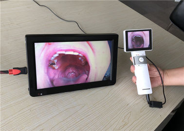 Video macchina fotografica Dermatoscope della gola dell'oftalmoscopio portatile dell'otoscopio con l'uscita di carta di deviazione standard per la clinica