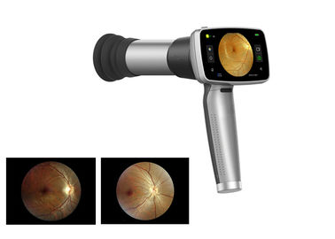 Video macchina fotografica tenuta in mano del fondo dell'oftalmoscopio 45°