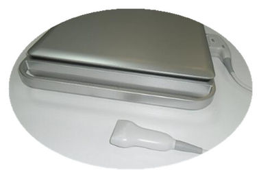 analizzatore di ultrasuono di doppler di colore 3d/doppler tenuto in mano con la batteria incorporata