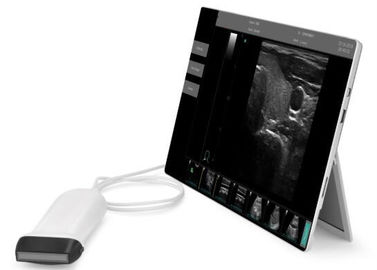 Macchina portatile di ultrasuono di Ipad dell'analizzatore di ultrasuono dell'attrezzatura di ricerca di ultrasuono con le sonde di 2~15MHz