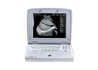 Analizzatore in bianco e nero portatile di ultrasuono della macchina di ultrasuono di Digital in quattro lingue
