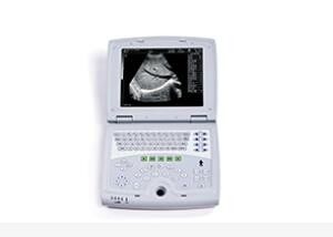 Analizzatore mobile di ultrasuono del computer portatile di Digital della macchina di ultrasuono con uno stoccaggio permanente di 100 pagine