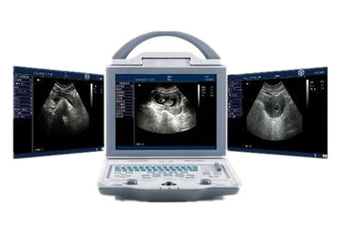 Analizzatore portatile di ultrasuono della macchina di ultrasuono dell'ospedale con i connettori doppi della sonda