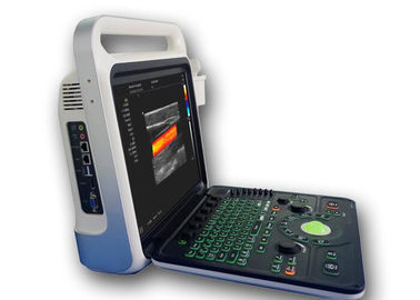 Analizzatore portatile di ultrasuono della macchina di rappresentazione di ultrasuono con capacità 160G