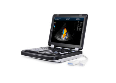 256 analizzatore portatile portatile di ultrasuono della macchina 3D Digital di ricerca di ultrasuono