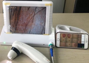 Digital video Dermatoscope tenuto in mano con lo schermo a 8 pollici 1,4,9 rappresenta la visualizzazione