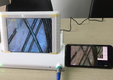 Analizzatore tenuto in mano della pelle di Dermatoscope della lente di Digital video con il rapporto di dati del pigmento dell'umidità dell'olio flessibile