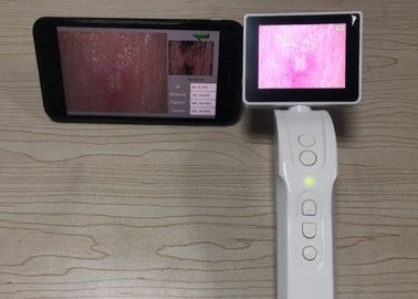 Video Dermatoscope Wifi collegamento tenuto in mano di Digital Dermatoscope allo schermo a 3,5 pollici del cellulare