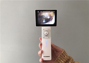 Rappresentazione generale e Dermatoscope del micro di deviazione standard della carta di USB dell'orecchio della macchina fotografica otoscopio di Digital video