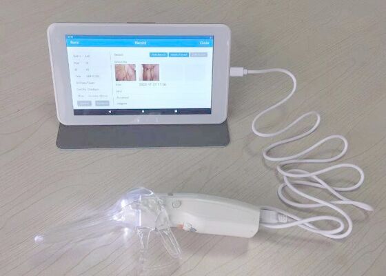 Video Colposcope di Digital per cura 10 della donna o macchina fotografica professionale del monitor medico a 7 pollici per ispezione della cervice