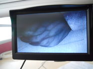 Immagini vascolari che visualizzano le vene nel cercatore infrarosso della vena dello schermo per gli infermieri e medici