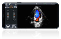 Trasduttore cardiaco di colore di ultrasuono della sonda dell'analizzatore di ultrasuono tenuto in mano senza fili di Digital