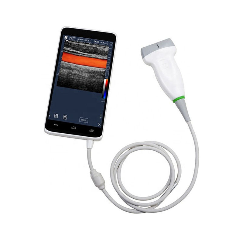 Analizzatore tenuto in mano di ultrasuono di colore di USB, peso leggero portatile del dispositivo di ultrasuono