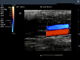 Analizzatore diagnostico portatile di ultrasuono di colore di Digital di colore della macchina piena di Dopple