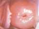 Colposcope cervicale tenuto in mano della macchina fotografica di Digital affinchè ginecologia ispezionino cervice con 80,0000 lo zoom di risoluzione 1~128 dei pixel