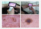 Ispezione OTORINOLARINGOIATRICA clinica otoscopio di Digital del corpo umano di video con l'otoscopio di TFT LCD USB di colore