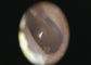 Ispezione completa di Digital dell'endoscopio otoscopio OTORINOLARINGOIATRICO di Digital del video con l'otoscopio di USB dell'uscita di carta di deviazione standard