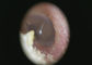 otoscopio medico astuto di CMOS USB di 1920 x 1080 pixel video per la pelle dell'orecchio e la rappresentazione generale