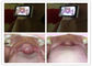 Ispezione completa di Digital del video otoscopio di Digital con l'otoscopio di USB dell'uscita di carta di deviazione standard