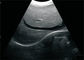 Zoom intelligente 12&quot; di gravidanza dell'analizzatore portatile di ultrasuono portato a mano LCD con la sonda convessa 3.5MHz