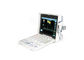 Doppler economico di ultrasuono di colore di Digital di colore dell'analizzatore portatile pieno di ultrasuono con la funzione di PW