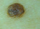 Lente senza fili portatile della pelle e dei capelli dell'otoscopio di Digital del microscopio del collegamento di WIFI video