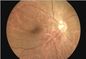 Macchina fotografica del fondo dell'oftalmoscopio H.264 Digital di ispezione