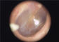 Endoscopio portatile medico disponibile dell'otoscopio del paraorecchie eliminabile per la gola dell'occhio dell'orecchio