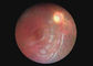Video endoscopio di Dermatoscope Digital dell'otoscopio dell'attrezzatura ottica della macchina fotografica oftalmica della gola con 2 milione pixel