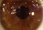 Macchina fotografica portatile dell'oftalmoscopio della lampada a fessura tenuta in mano