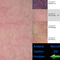 Analizzatore senza fili Digital della pelle del tester della pelle e del cuoio capelluto di Wifi con 8&quot; visualizzazione di Photoes dello schermo 9