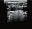 Radio tenuta in mano diagnostica dell'attrezzatura dell'analizzatore di ultrasuono con 8 adeguamenti di TGC