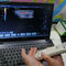 Analizzatore tenuto in mano di ultrasuono di colore della macchina portatile di doppler con frequenza 2~11MHz