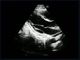 Analizzatore fetale di ultrasuono di doppler di colore di lingua di Mutil con la sonda convessa micro-