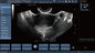 Analizzatore transvaginale di ultrasuono di doppler di colore della sonda, gravidanza tenuta in mano di doppler