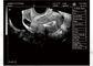 Macchina portatile di ultrasuono per il peso portatile 2.2kgs dell'analizzatore di ultrasuono di gravidanza soltanto