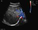 Analizzatore portatile di ultrasuono di gravidanza con i trasduttori transvaginali convessi addominali